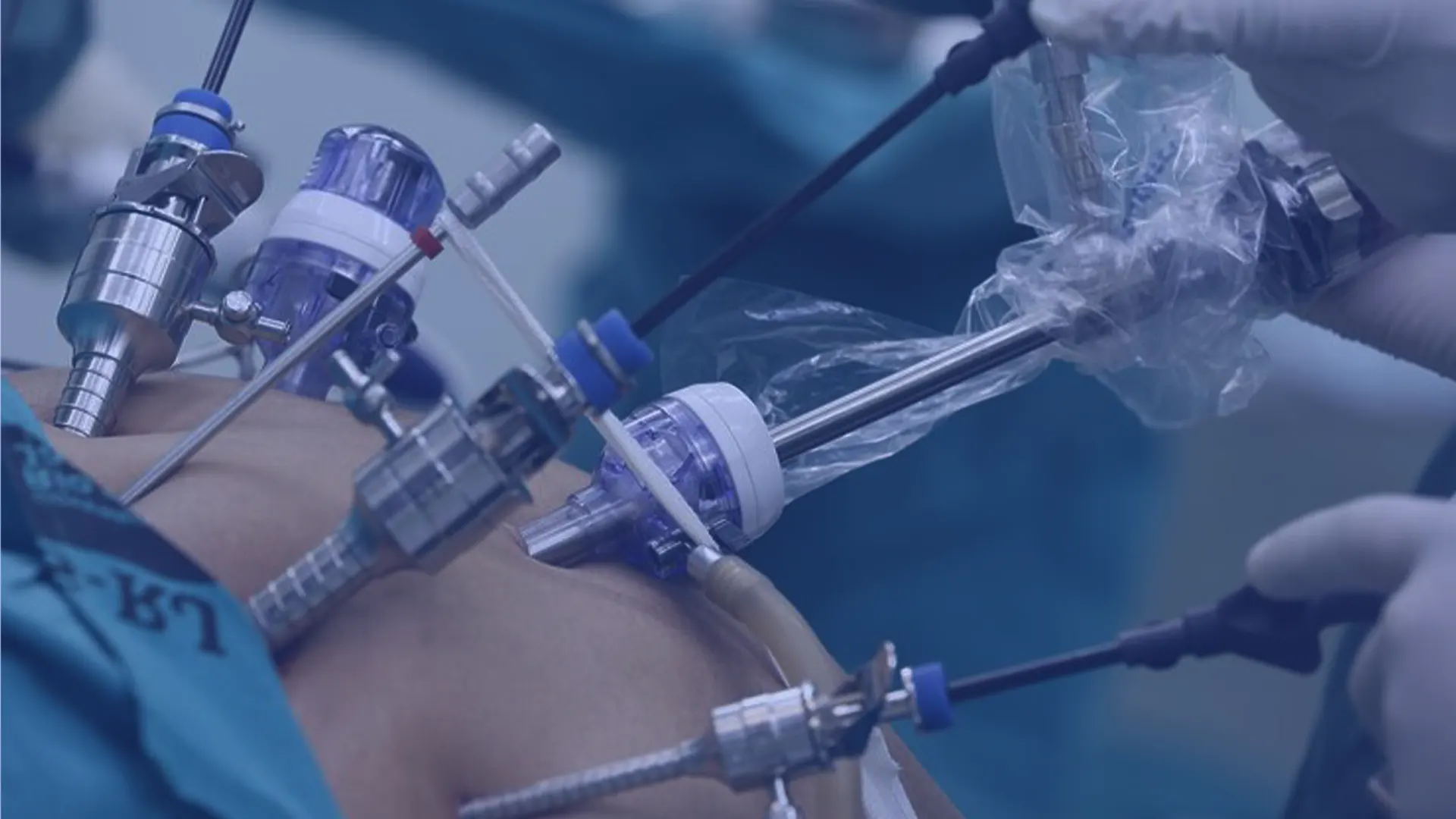 Laparoscopic surgeon sleeve