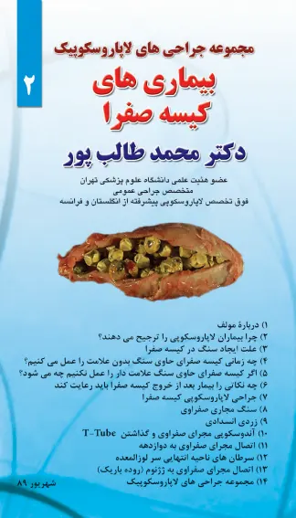 بیماری های کیسه صفرا