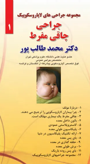 جراحی چاقی مفرط