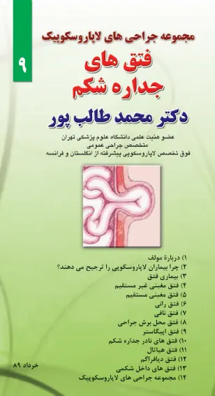 فتق های جداره شکم