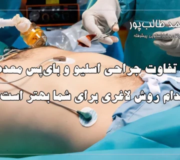 تفاوت جراحی اسلیو و بای‌پس معده | کدام روش لاغری برای شما بهتر است؟