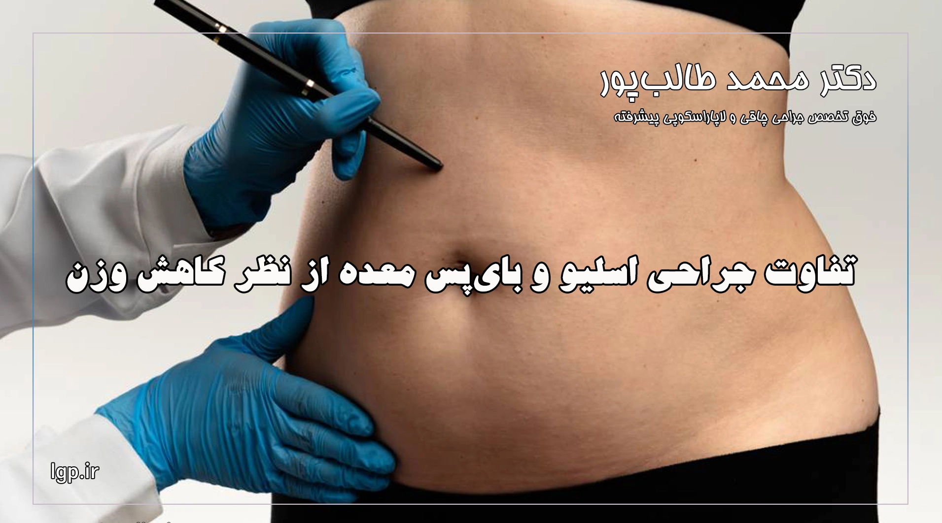 تفاوت جراحی اسلیو و بای‌پس معده از نظر کاهش وزن