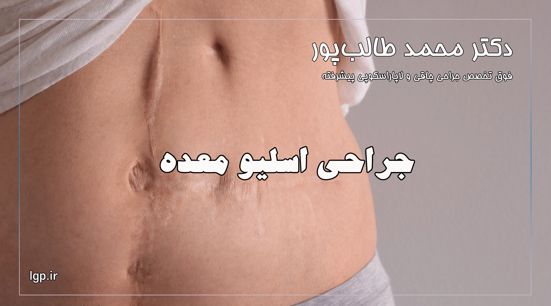 جراحی اسلیو معده