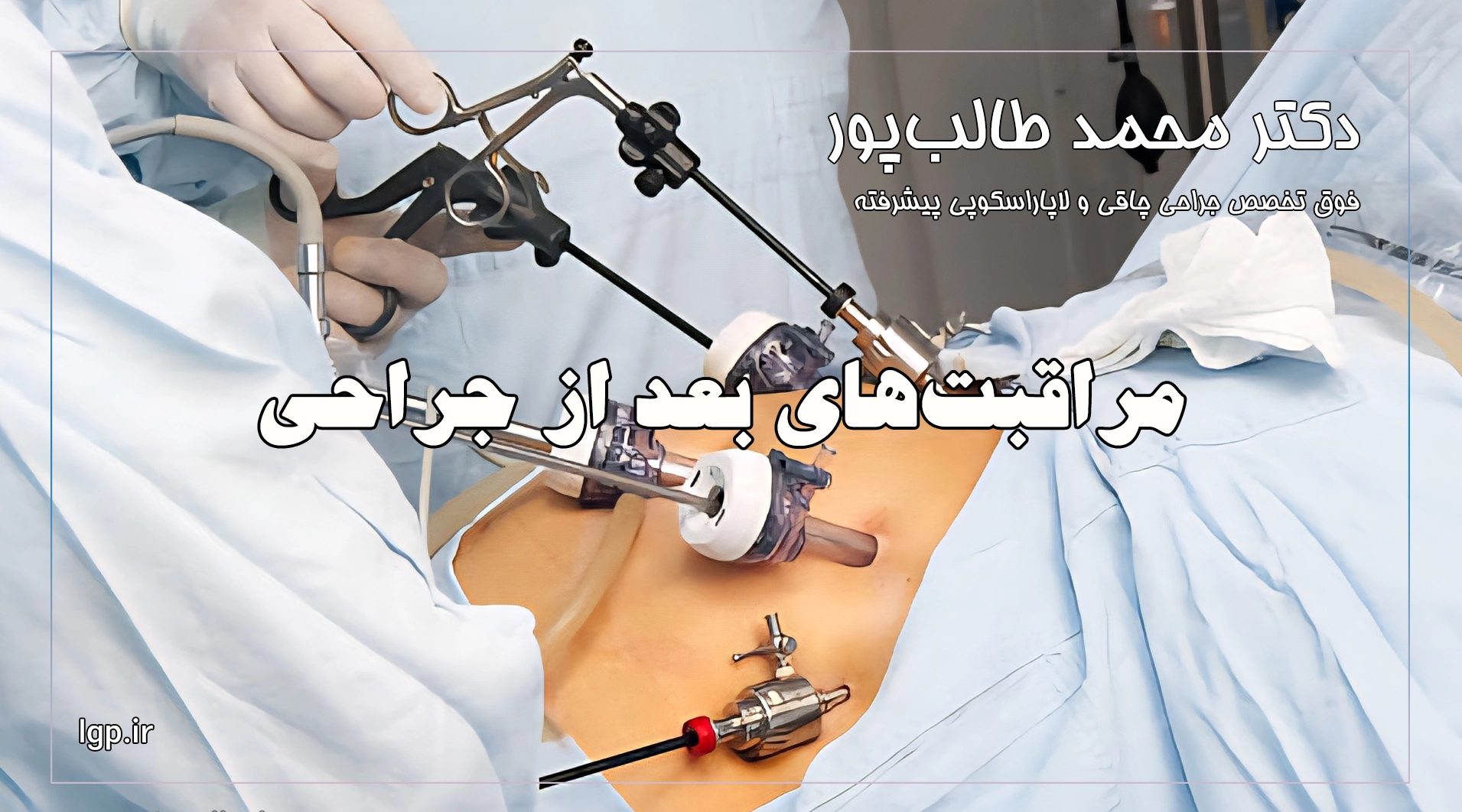 جراحی اسلیو معده