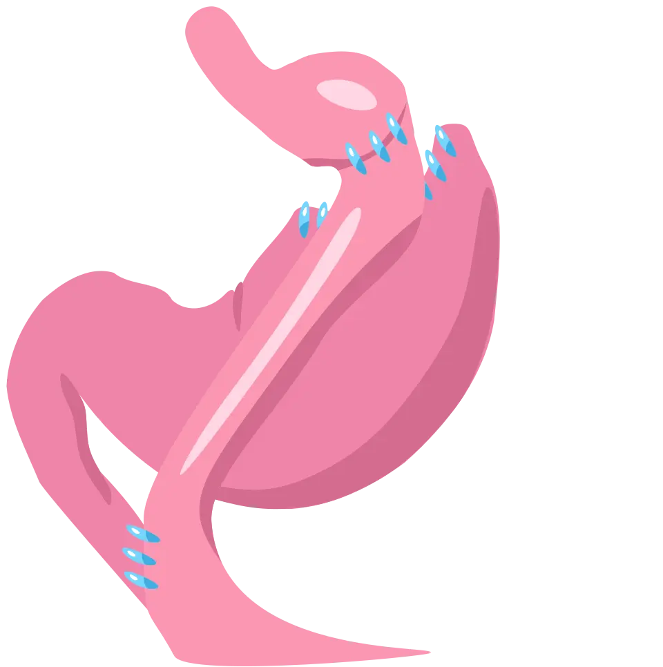 ابزار و تجهیزات جراحی لاپاراسکوپی فتق